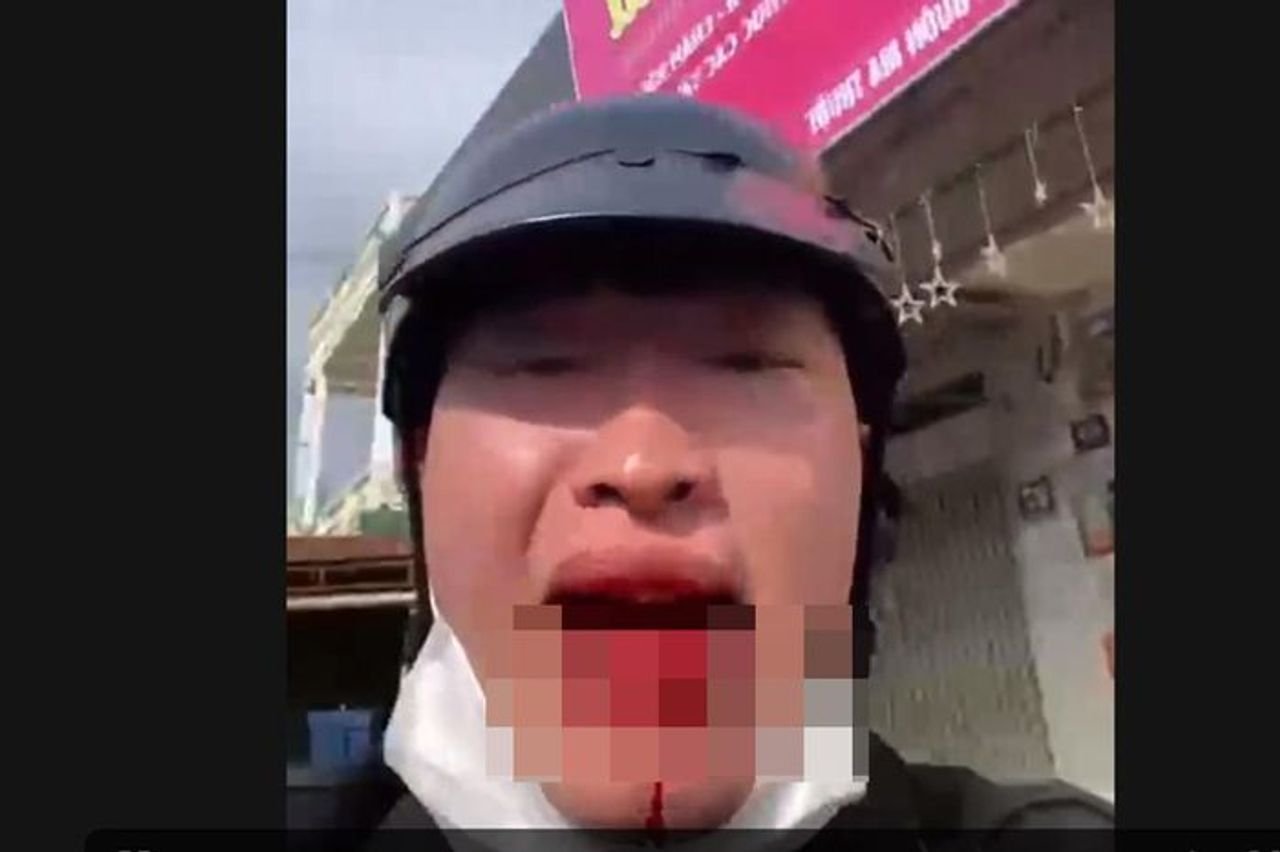 Người đàn ông chặn xe đánh người, hỏi: 'Mày biết tao là ai không?' - Báo Pháp Luật TP.HCM